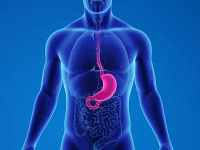 O que é a cirurgia metabólica?