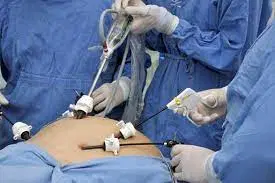 Cirurgia videolaparoscopia