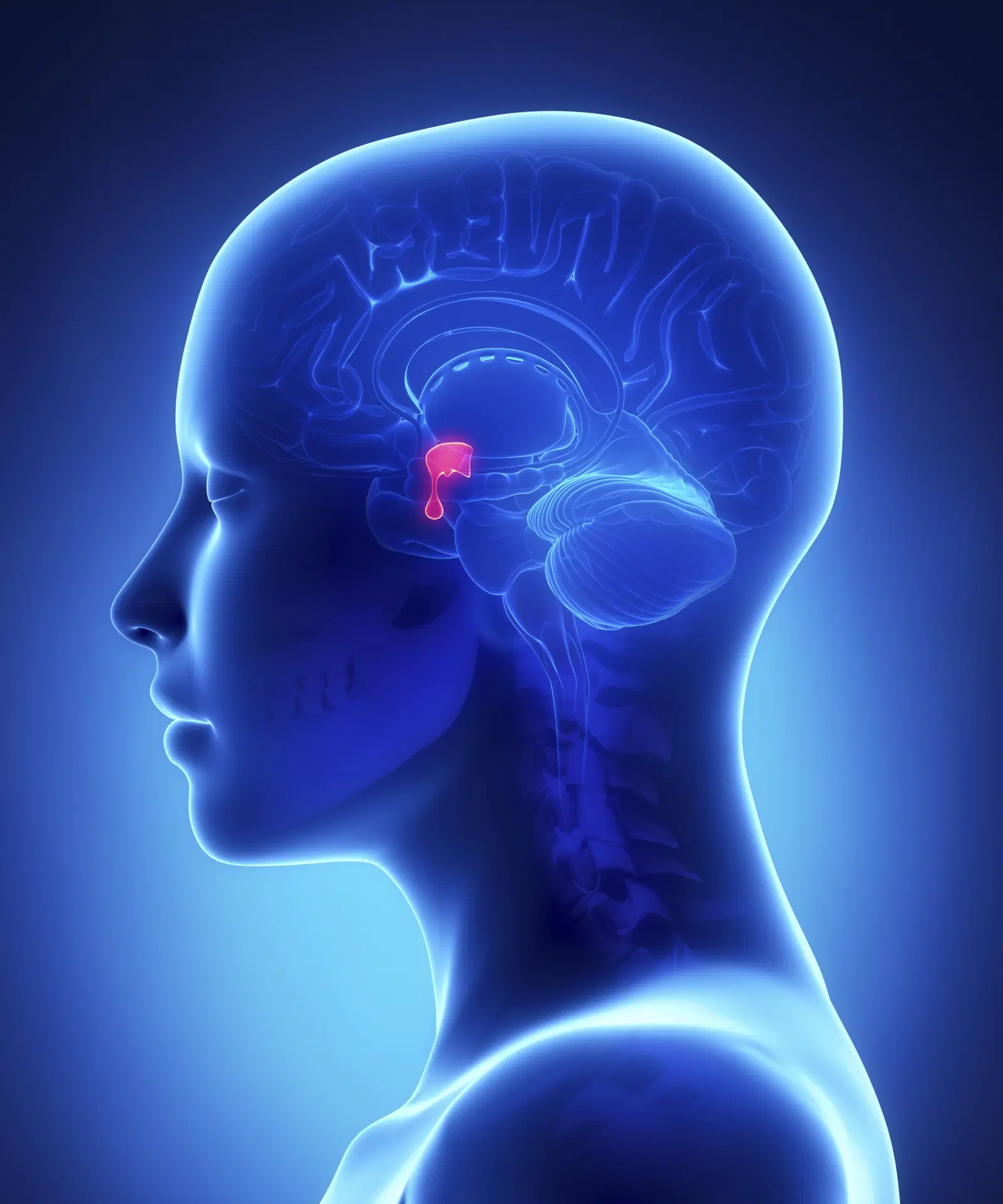 TUMOR DE HIPÓFISE