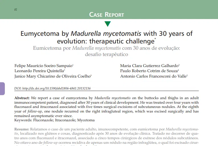 Artigo: Eumicetoma por Madurella mycetomatis com 30 anos de evolução: desafio terapêutico