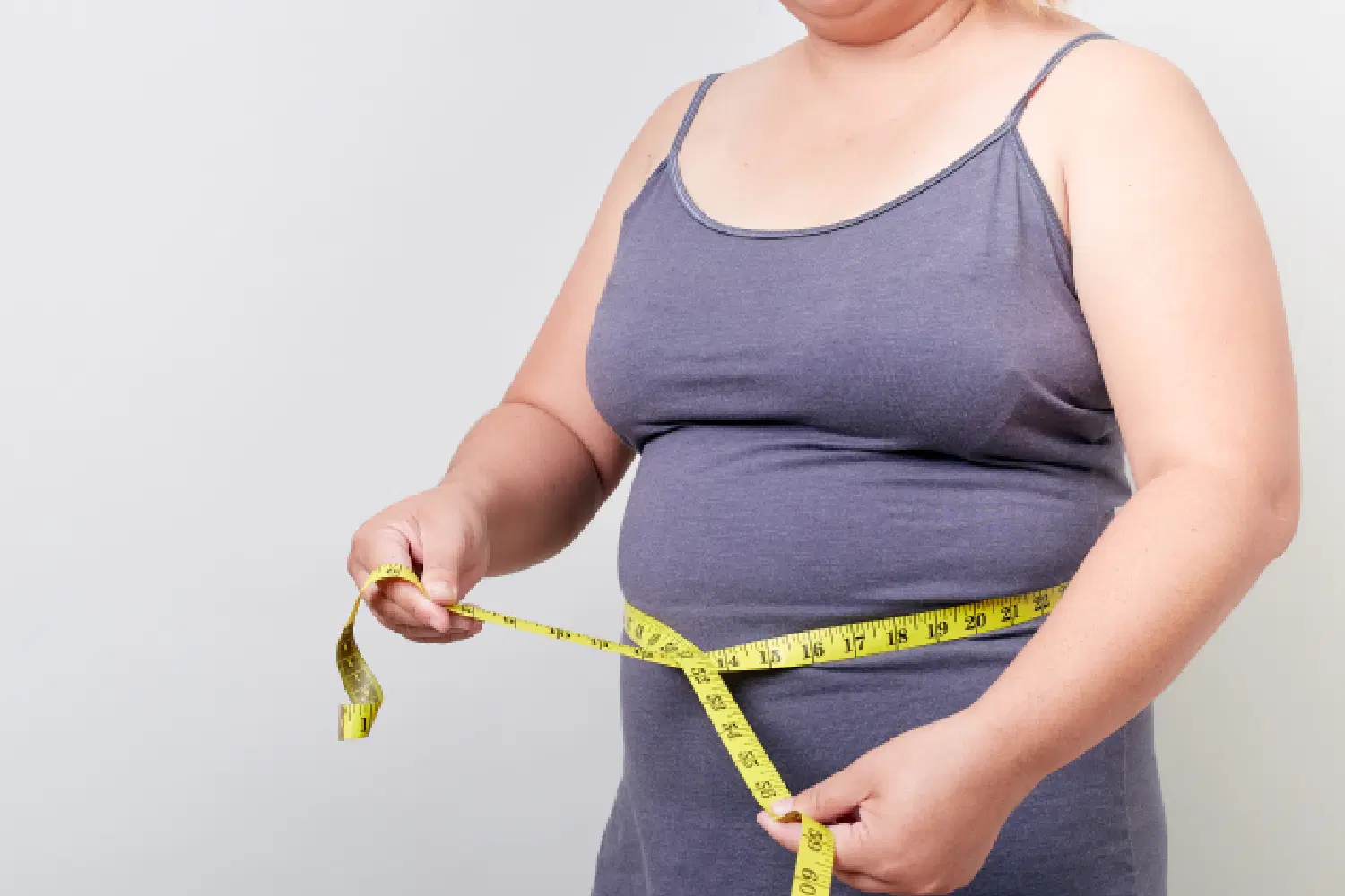 Como saber se a cirurgia bariátrica é indicada para você?