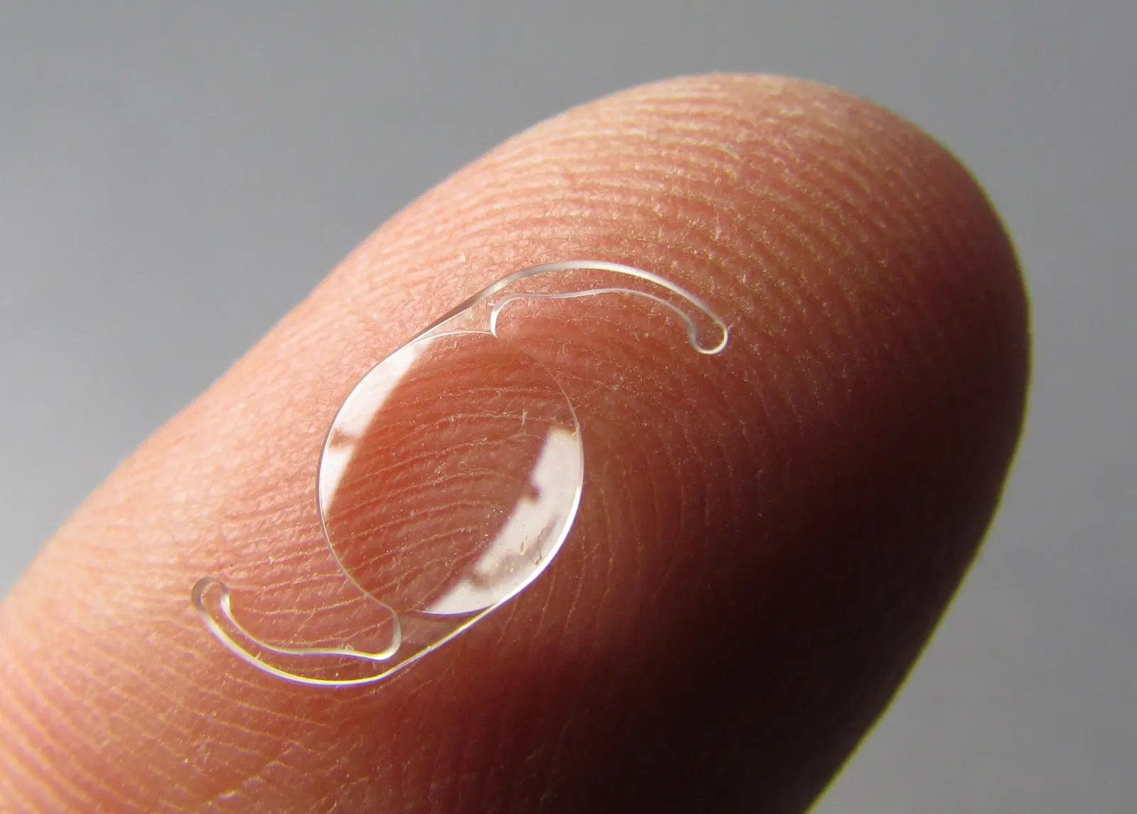 IMPLANTE DE LENTES