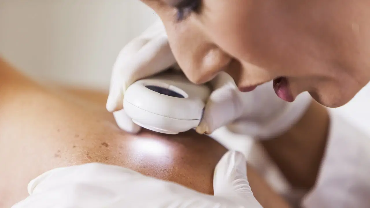 Dermatologia Clínica