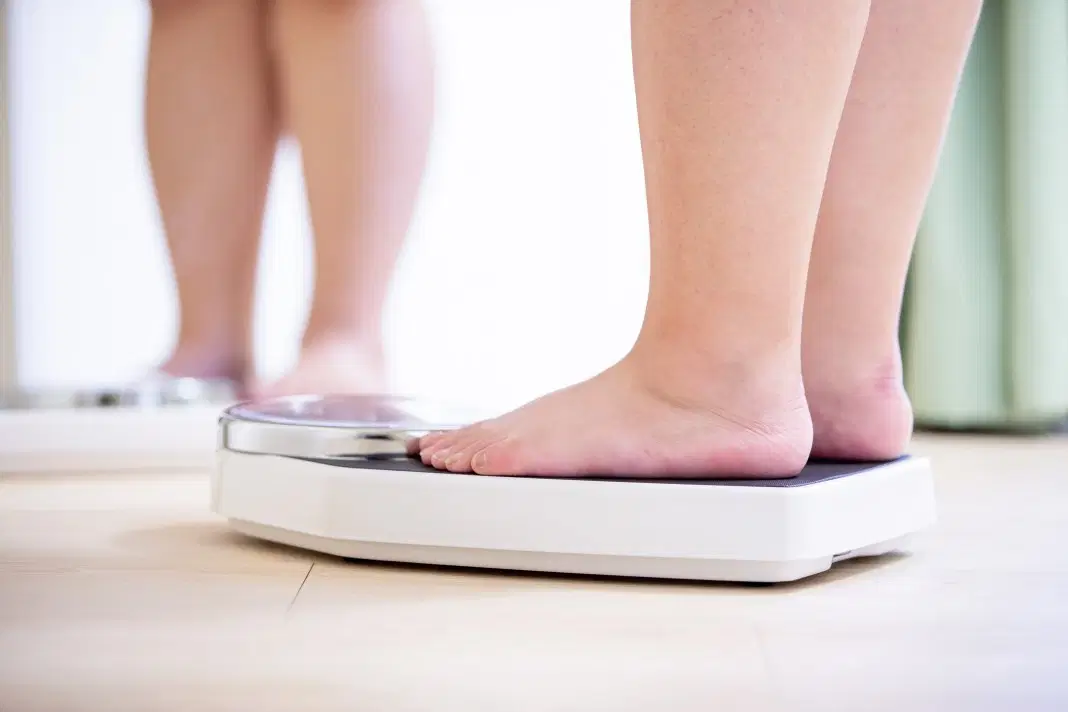 O que é obesidade mórbida?