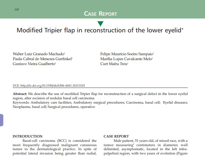 Artigo: Modified Tripier flap in reconstruction of the lower eyelid*
