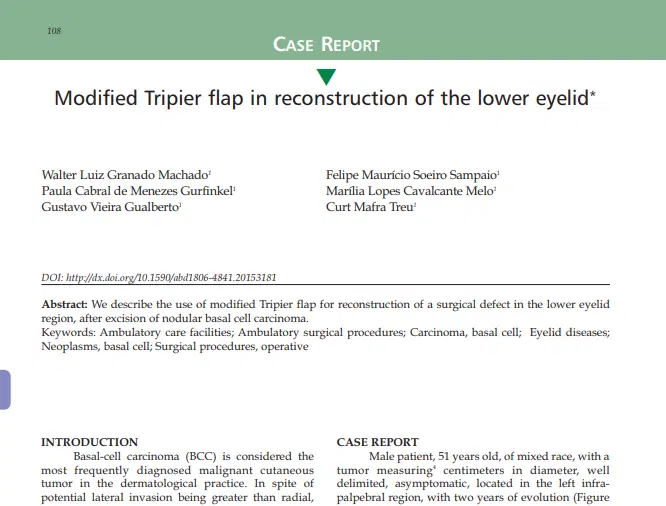 Artigo: Modified Tripier flap in reconstruction of the lower eyelid*