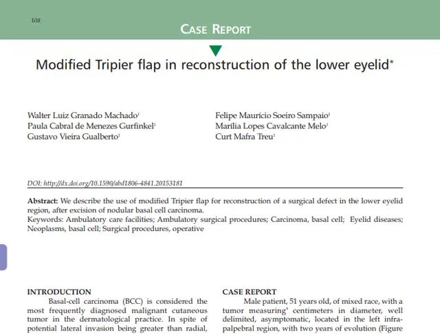 Artigo: Modified Tripier flap in reconstruction of the lower eyelid*