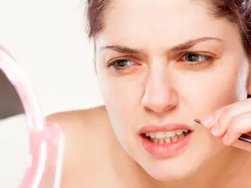 Hirsutismo, o excesso de pelos nas mulheres