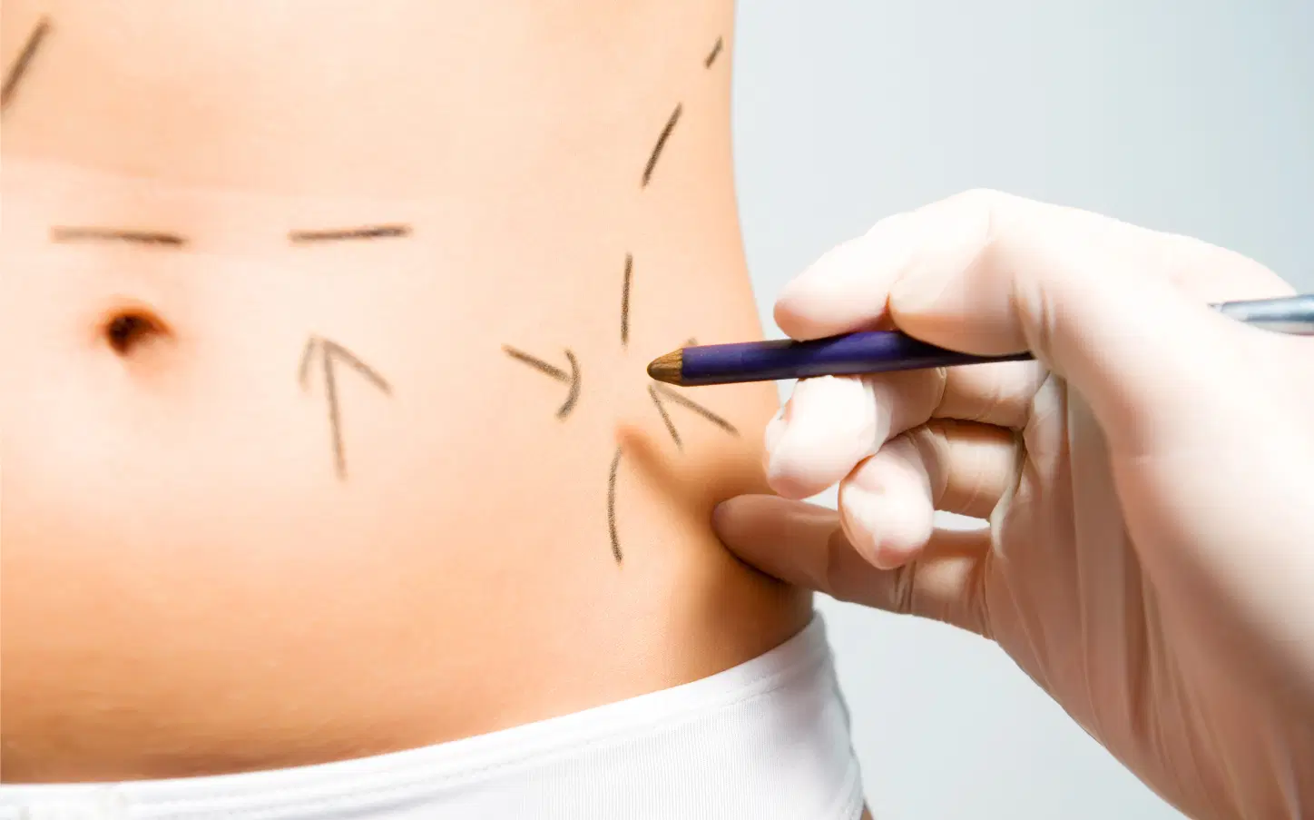 5 perguntas e respostas sobre cirurgia plástica