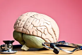 É possível prevenir o rompimento do aneurisma cerebral?