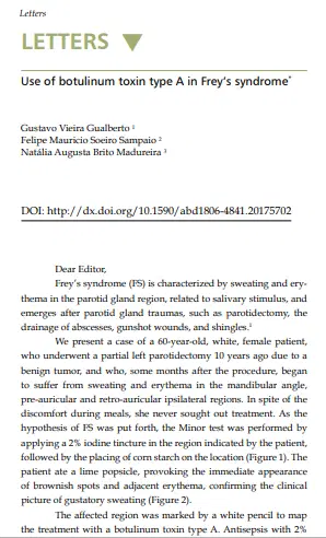 Artigo: Use of botulinum toxin type A in Frey's syndrome