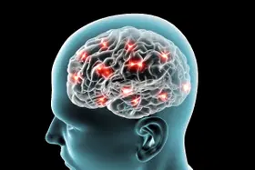 O que é angioma cavernoso e quais são os seus sintomas?