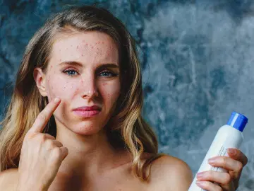Dermatite de contato alérgica: a origem das alergias aos cosméticos