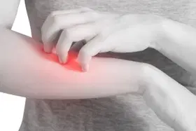 O que é eczema?