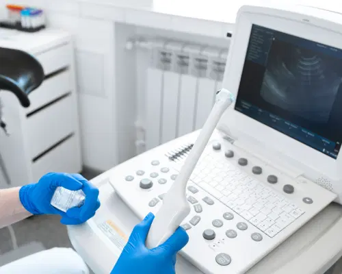 Ultrassom transvaginal: o que é, para que serve e quando fazer?
