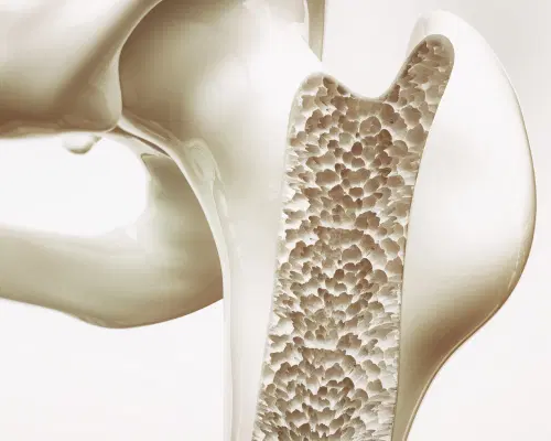 A osteoporose e pós-menopausa