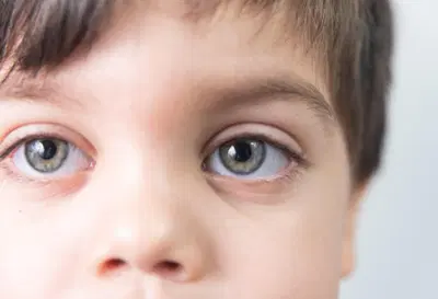 Retinoblastoma: quando o brilho nos olhos é um sinal de alerta