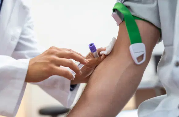 Colesterol alto pode não causar sintomas, mas merece atenção