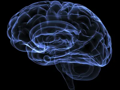 Neurocirurgia endovascular - tratamento cirúrgico das doenças neurovasculares