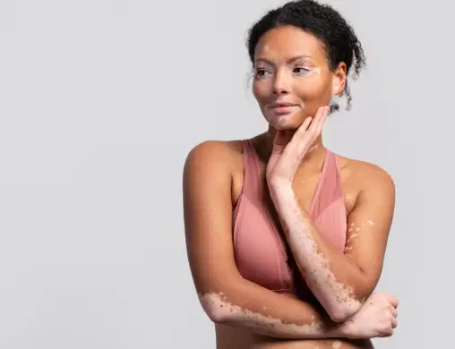 Manchas na pele: quando procurar um dermatologista?