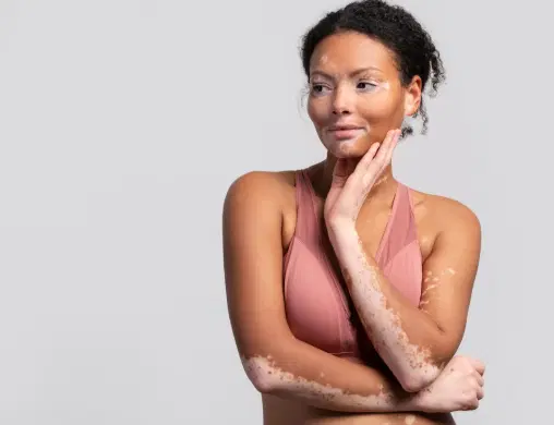 Manchas na pele: quando procurar um dermatologista?