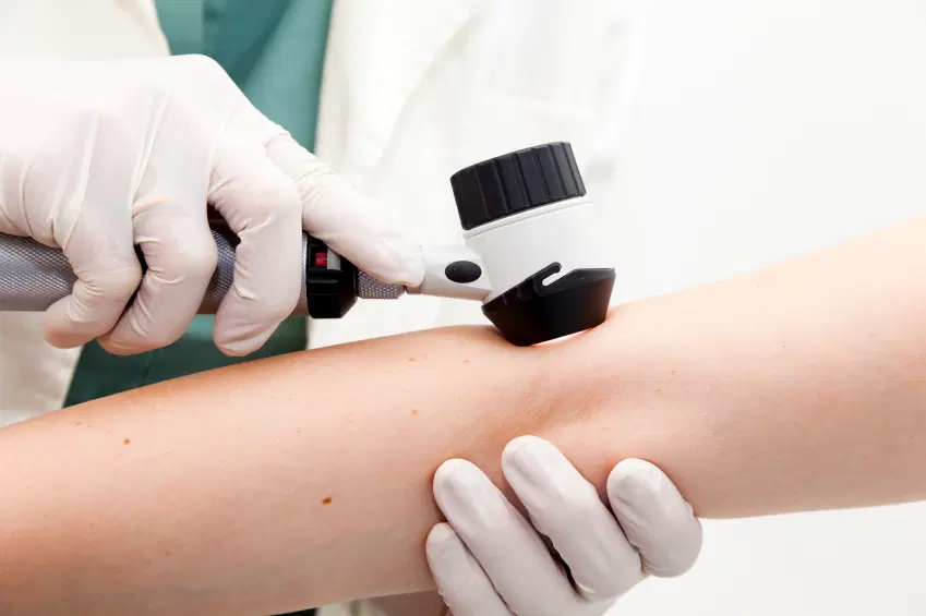 Dermatoscopia - Cocchetto
