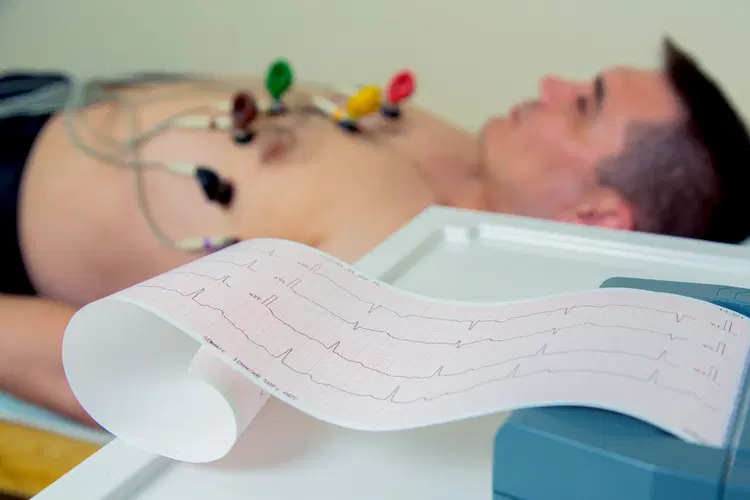 ELETROCARDIOGRAMA