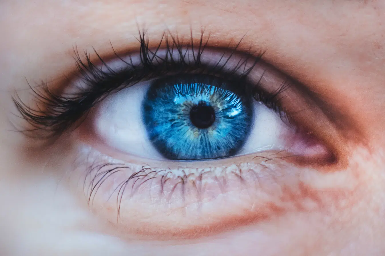 Alerta sobre Retinoblastoma: Sinais a Serem Observados nos Olhos das Crianças