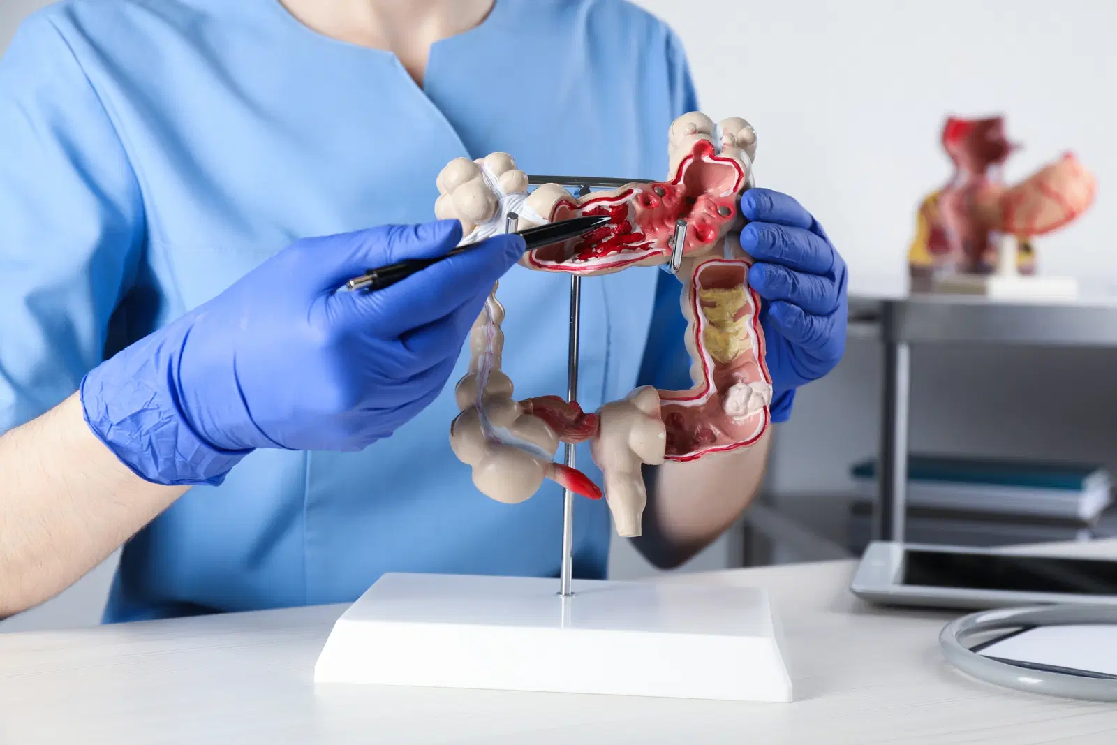 Consultas em gastroenterologia — Matheus Frederico