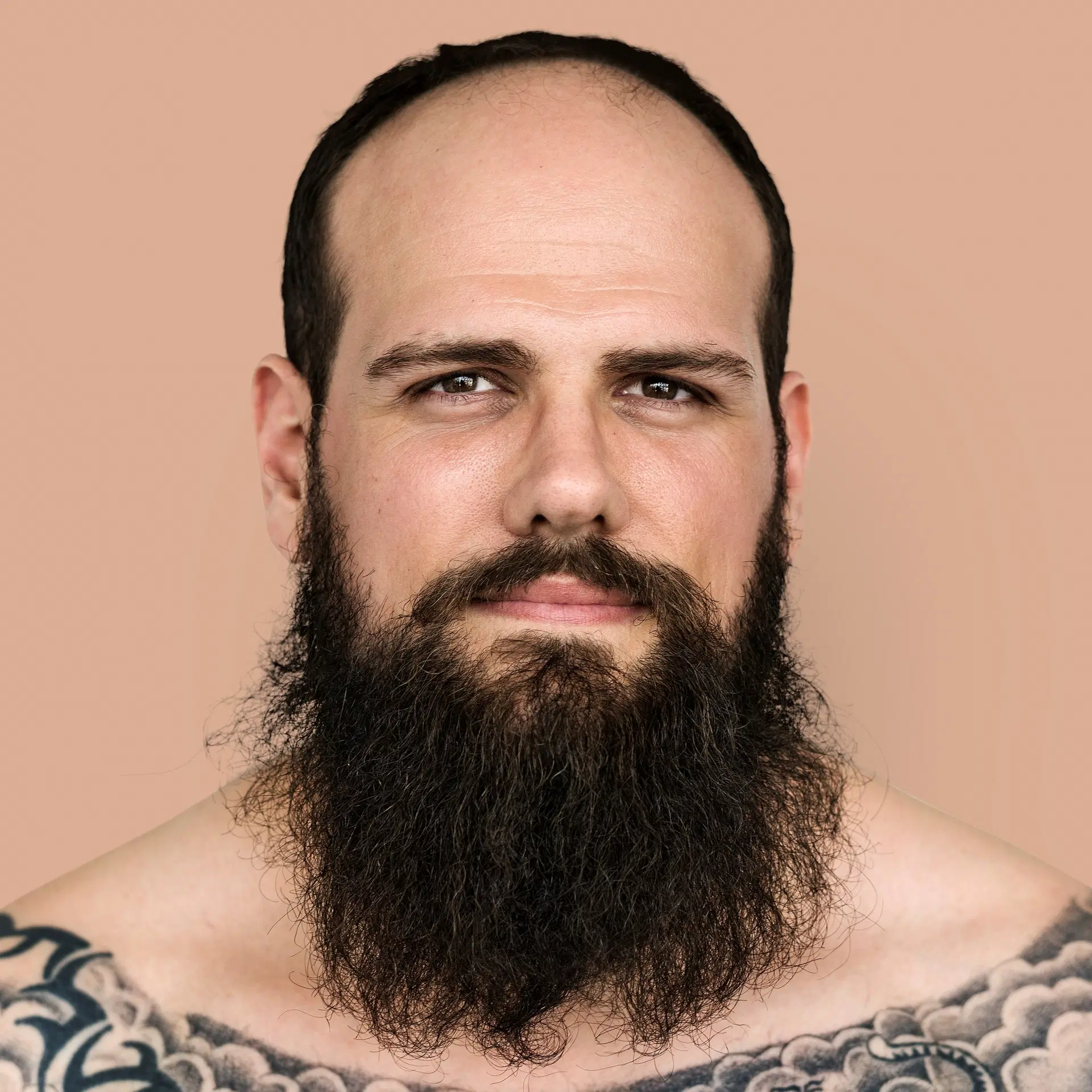 O que é alopecia e quais são os tratamentos?