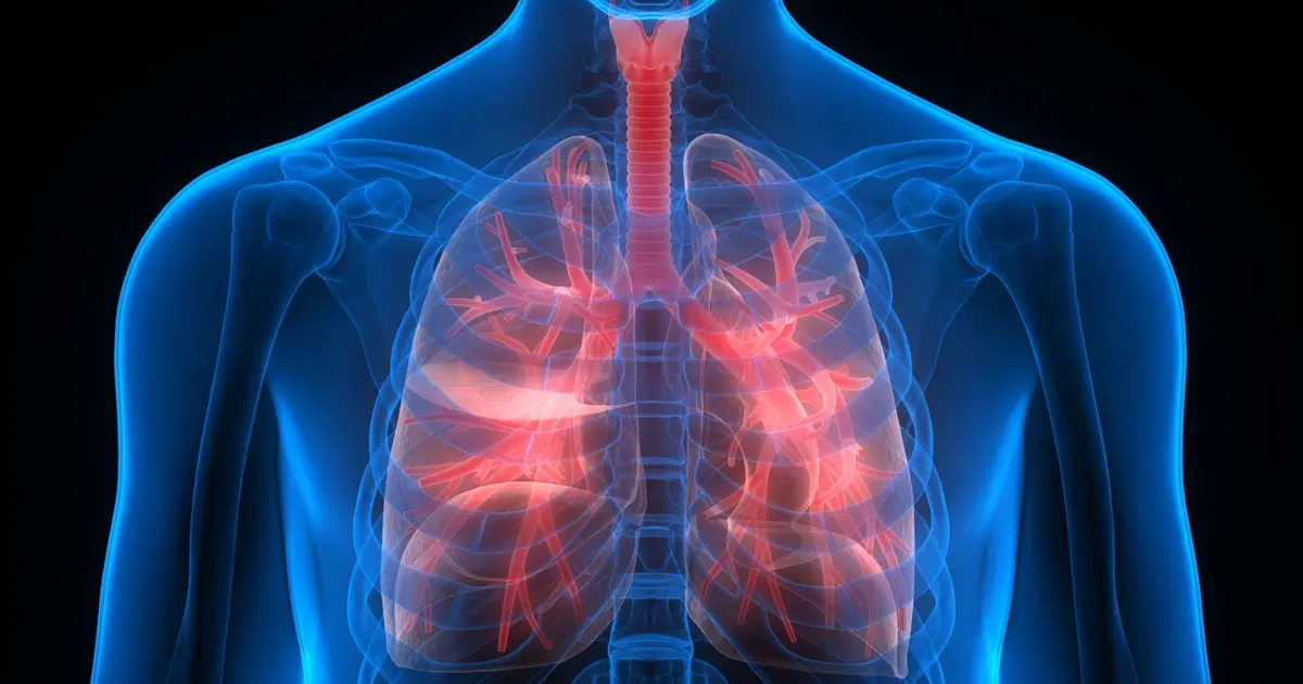 O que é a doença pulmonar obstrutiva crônica (DPOC)?