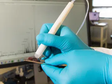 MasSpec Pen, a caneta capaz de diagnosticar um câncer