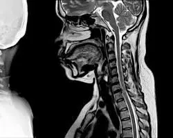 Coluna cervical