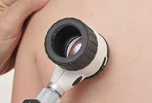 Dermatologia Clínica