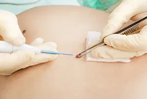 Dermatologia Cirúrgica