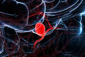 Como é feita a cirurgia de aneurisma cerebral?