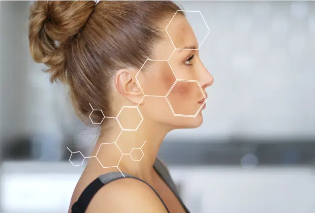 3 erros comuns que pioram o melasma (e como evitá-los)