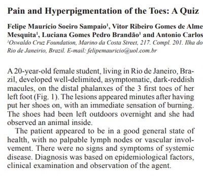 Artigo: Pain and Hyperpigmentation of the Toes: A Quiz