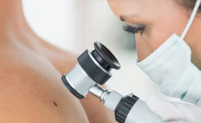 Dermatoscopia