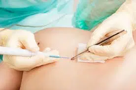 Dermatologia Cirúrgica
