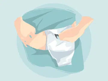 O que é e para que serve a colostomia?