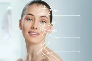 Fios de Sustentação
