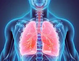 O que é bronquiecstasia e por que acontece?