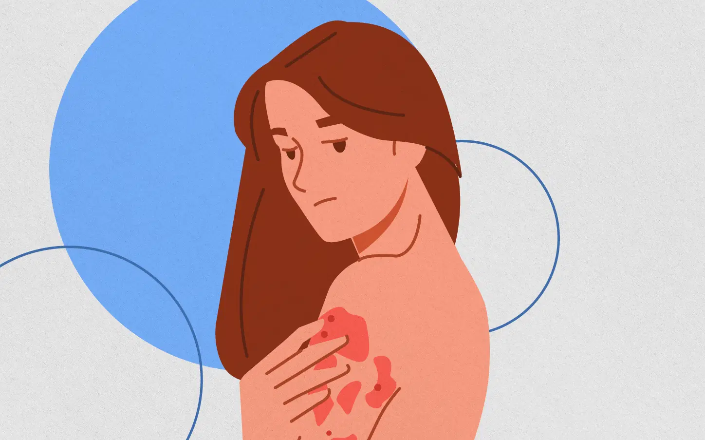 Como identificar os sinais da dermatite atópica