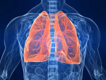 O que é fibrose pulmonar idiopática?