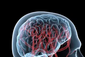 Seu neurocirurgião indicou uma angiografia cerebral? Entenda para que serve o exame