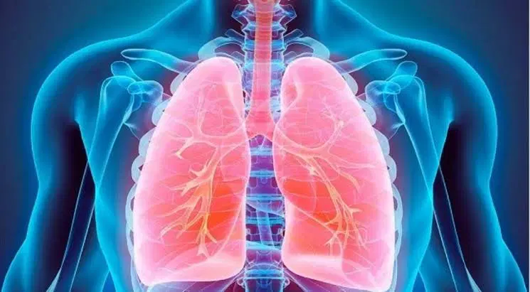 Doença Pulmonar Obstrutiva Cronica (DPOC)