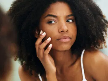 Por que a pele negra está mais suscetível a manchas?