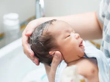Como lidar com a acne neonatal?