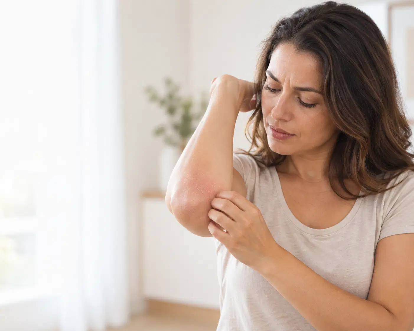 Dermatite atópica: por que a coceira volta e como quebrar esse ciclo?